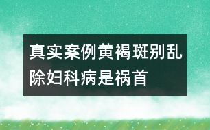 真實(shí)案例：黃褐斑別亂除婦科病是禍?zhǔn)?></p>										
													<p>　　盧小姐從小臉上就有很多雀斑。近幾年來(lái)，她臉上又逐漸冒出許多黃褐斑。雖然表面上她并不在意，但心里是很自卑的。她偷偷服用了很多保養(yǎng)品，買名貴化妝品來(lái)改善，可得要么沒(méi)效果，要么就反反復(fù)復(fù)。有些含汞的不良化妝品，短期內(nèi)祛斑效果十分明顯，還有增白的效果，但很快就卷土重來(lái)，并且更加嚴(yán)重。又聽(tīng)說(shuō)某些美容院可以用激光祛斑，她冒險(xiǎn)嘗試。效果一般，而且術(shù)后皮膚又薄又敏感。結(jié)果，最近單位組織體檢，她被查出子宮肌瘤，卵巢上還有小囊腫。 </p><p>　　上海市計(jì)劃生育科研所附屬博康生殖醫(yī)院主任醫(yī)師方廣虹指出，中醫(yī)醫(yī)書自古就有“有諸內(nèi)，必形于諸外者也”的評(píng)價(jià)，認(rèn)為黃褐斑與子宮肌瘤的有共同的發(fā)病原因，它們多與情緒因素相關(guān)，即“隨喜怒而消長(zhǎng)”。如怒氣傷肝，肝瘀氣滯，血運(yùn)不暢，胞脈受阻，血室失養(yǎng)，日久痰濕血瘀內(nèi)停，下行胞宮，積于子宮，故可結(jié)為子宮肌瘤；情志郁結(jié)，導(dǎo)致內(nèi)分泌失調(diào)，代謝廢物不能排出體外，瘀積于皮下，色素沉著而形成面部黃褐斑。</p>						</div>
						</div>
					</div>
					<div   id=