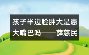 孩子半邊臉腫大是患大嘴巴嗎――薛慈民回答