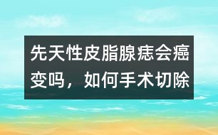 先天性皮脂腺痣會癌變嗎，如何手術(shù)切除