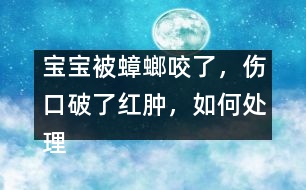 寶寶被蟑螂咬了，傷口破了紅腫，如何處理