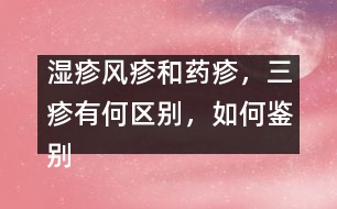 濕疹風(fēng)疹和藥疹，三疹有何區(qū)別，如何鑒別