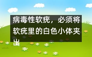 病毒性軟疣，必須將軟疣里的白色小體夾出