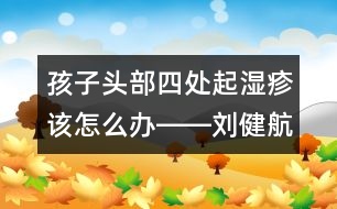 孩子頭部四處起濕疹該怎么辦――劉健航回答